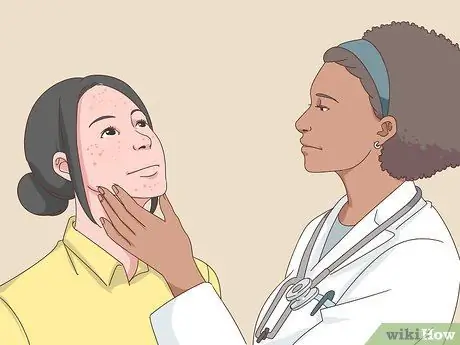 Быстрое избавление от прыщей, шаг 16