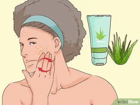 Избавиться от лопнувшего прыща за одну ночь Шаг 9