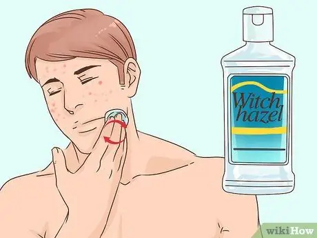 Избавиться от лопнувшего прыща за ночь, шаг 10