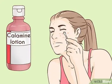 Избавиться от лопнувшего прыща за одну ночь Шаг 8