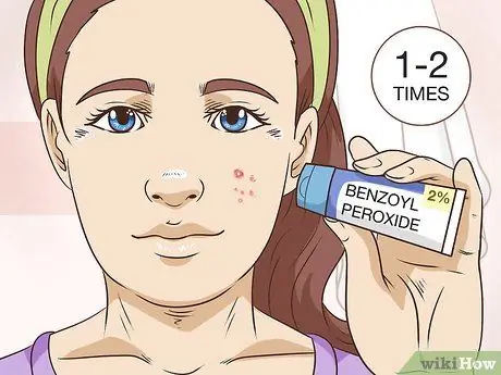 Безболезненно вытолкните прыщ Шаг 15