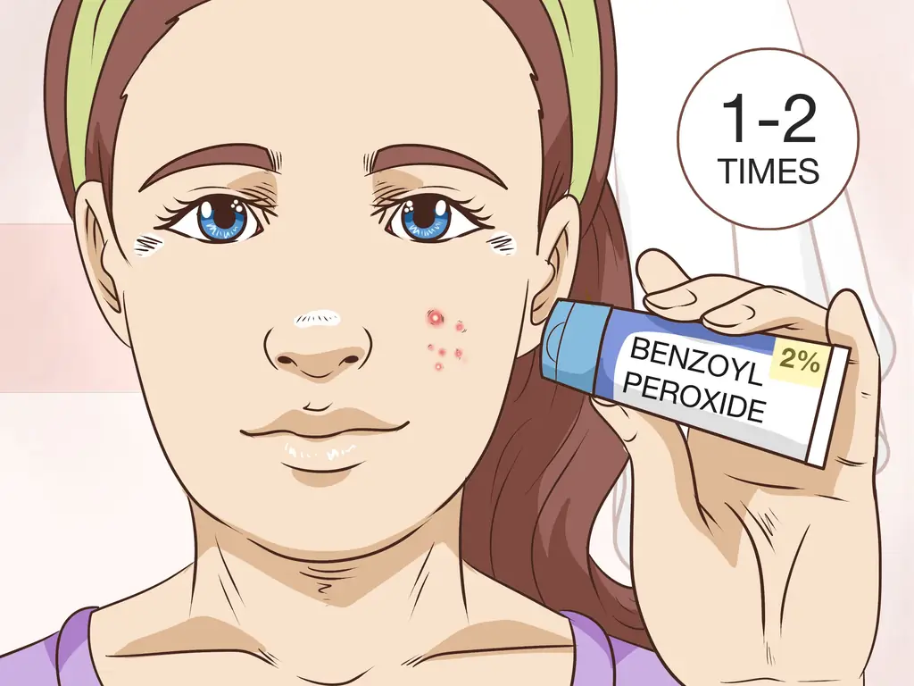 3 способа безболезненно избавиться от прыща