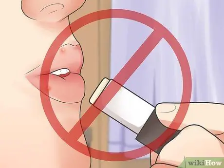 Быстрое избавление от прыщей вокруг губ, шаг 5