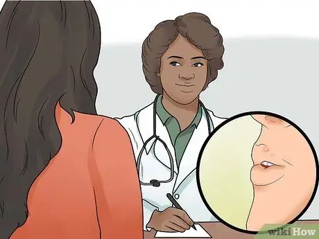 Быстрое избавление от прыщей вокруг губ, шаг 10