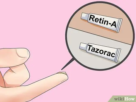 Быстрое лечение прыщей вокруг губ, шаг 11