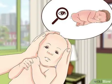 Как справиться с алкогольным синдромом у плода Шаг 1