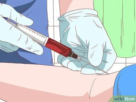 Распознать алкогольный синдром у плода Шаг 8