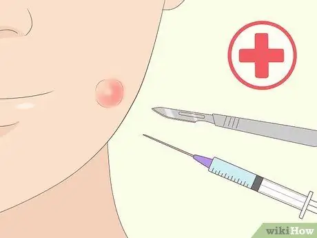 Скрыть прыщи Шаг 6