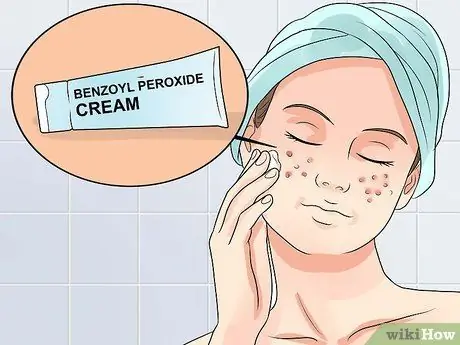 Очистить легкие прыщи Fast Step 1