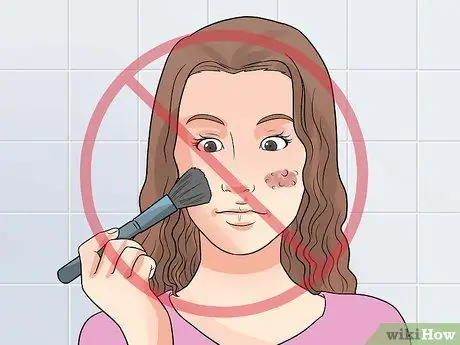 Очистить легкие прыщи Fast Step 8