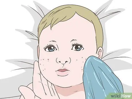 Избавиться от детских прыщей, шаг 2