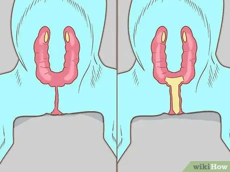 Предотвратить пиометру у собак Шаг 8