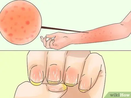 Приведи форму перед свадьбой Шаг 3