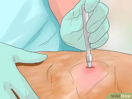 Диангозная ювенильная дисплазия почек у ши-тцу Шаг 7