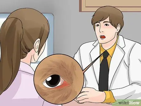 Диагностика конъюнктивита у собак Шаг 11