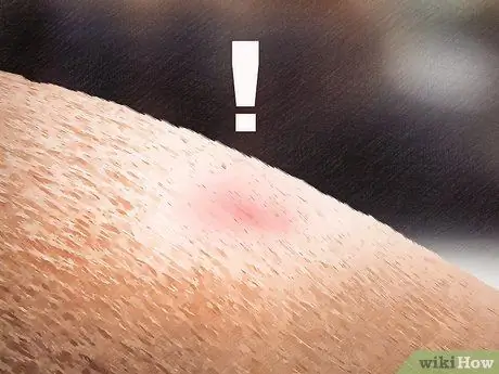 Удаление клеща с лошади Шаг 17