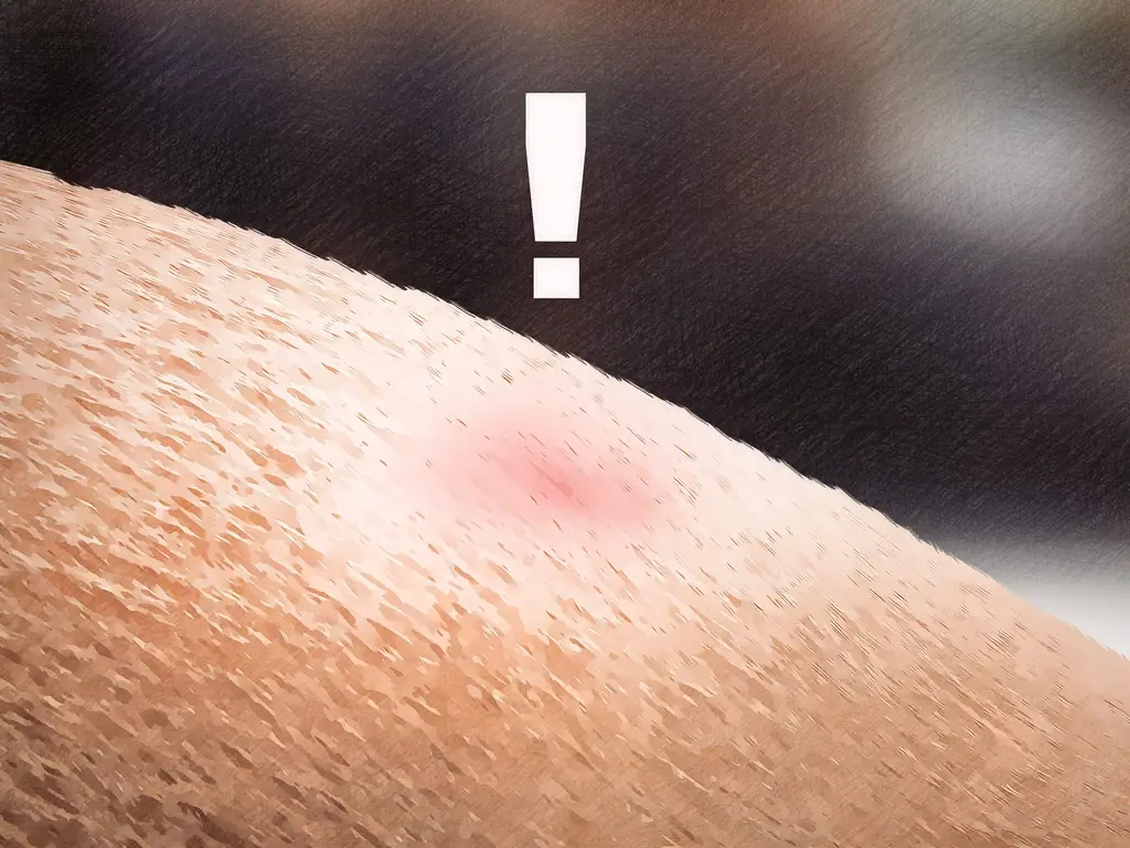 4 способа удалить клеща с лошади