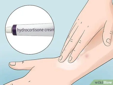 Лечите укусы инфицированных насекомых в домашних условиях Шаг 3