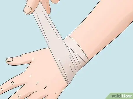 Лечите укусы инфицированных насекомых в домашних условиях Шаг 6