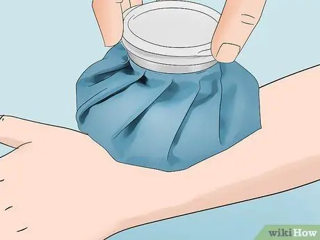 Лечите укусы инфицированных насекомых в домашних условиях Шаг 7