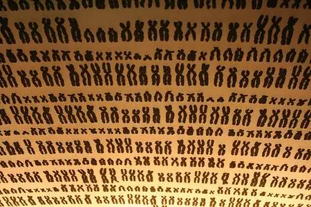 Боже мой, у ребенка синдром Дауна! Или нет? - О достоверности генетических тестов