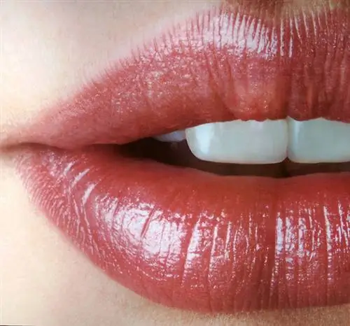 Улыбка Кардашьян за 30 минут: 5 способов отбеливания зубов в домашних условиях