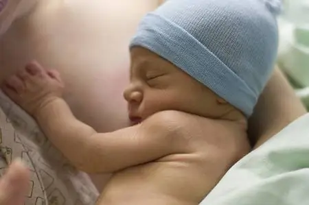 Больничный монитор: SOTE 2