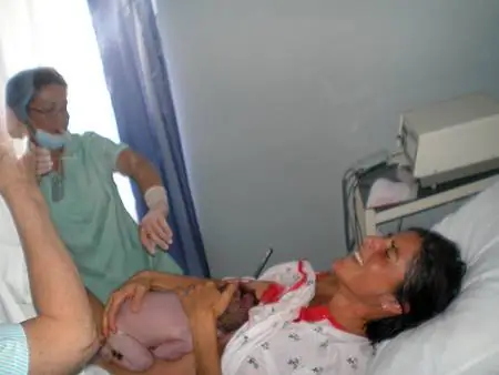 Лилко родилась с фиолетовым телом и наклоненной головой