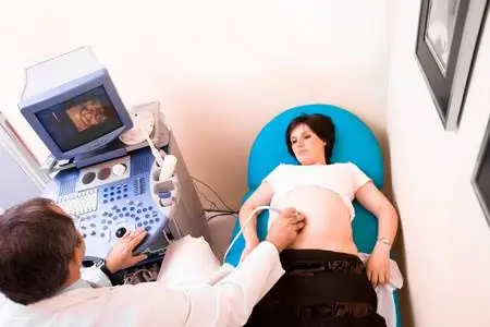 Дневник беременности Джоанны: в 4D мой сын показал только свое печенье