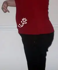 Дневник беременности 5.0: Опасен ли рахит для будущих мам в Англии?