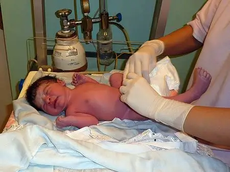 Роды - это не говно, это ужас