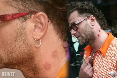 Перерезанные и перекусанные глотки