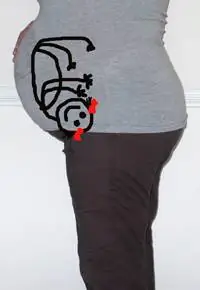 Дневник беременности 5.0: Будущая мама выбирает кесарево сечение