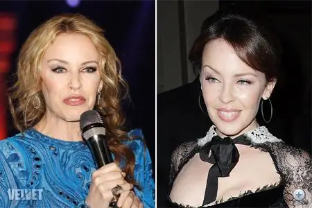 Кайли Миноуг утверждает, что ее лицо не парализовано