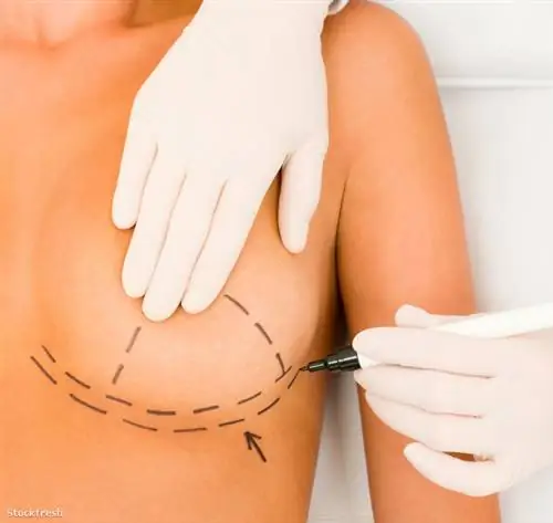 Преображение мамочки: за полтора миллиона можно получить полный генерал после родов