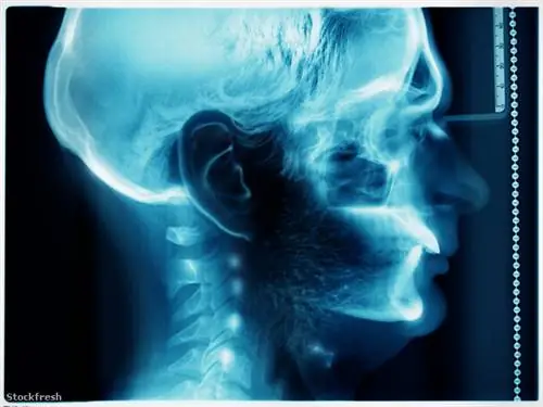 Stockfresh 956888 реальный и рентгеновский размерM