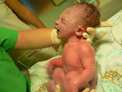 Здравствуй, маленький Пикхед!