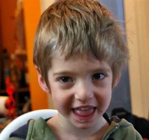 Наконец-то дома после операции, счастливый