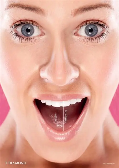 Реклама бриллиантов заставляет женщин выглядеть глупо