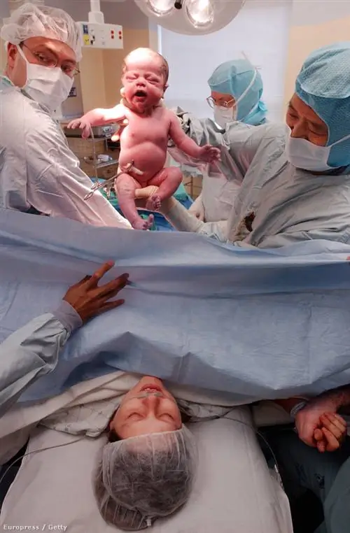 Я боролась, чтобы родить путем кесарева сечения