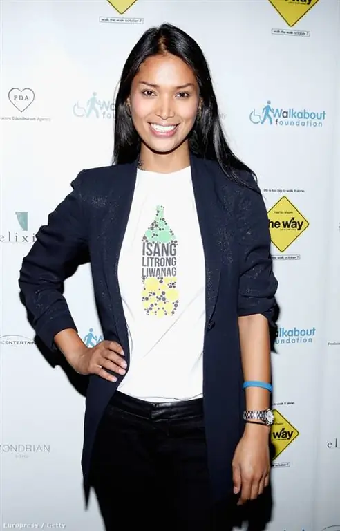 Джина Росеро перенесла операцию в 19 лет