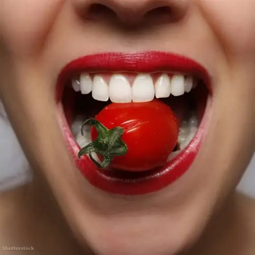 жалюзи 76050193