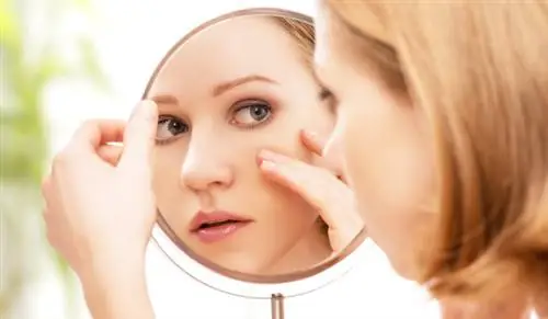 11 распространенных заблуждений о прыщах у взрослых