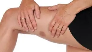 Вот почему он всегда весь в синяках