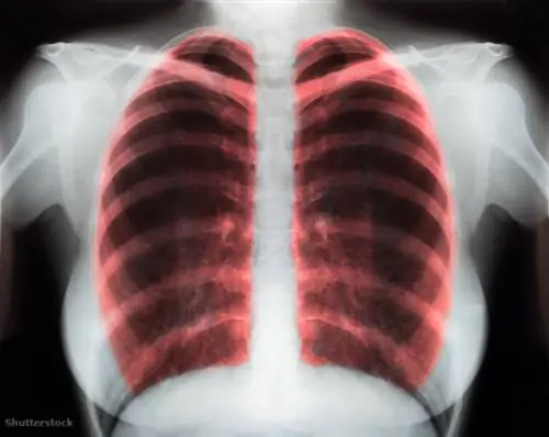 жалюзи 115055542