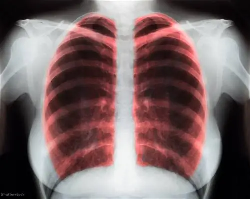 «Легких, которые у меня есть, хватит еще на 15 лет»