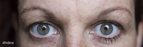 Один слой на левом глазу, на правом ничего. Если кликнуть на картинку, то можно увидеть ее в большем размере!