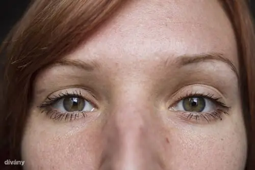 У него даже ресниц нет!!!