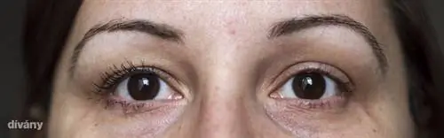 Один слой на правый глаз, ничего на левый. Если кликнуть на картинку, то можно увидеть ее в большем размере!