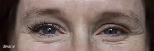 Один слой на правый глаз, ничего на левый. Если кликнуть на картинку, то можно увидеть ее в большем размере!